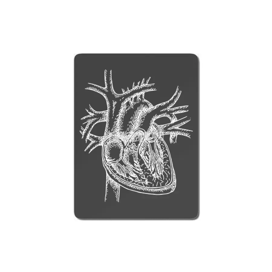 The Dissected Heart Sketch (White) MDF Tablo